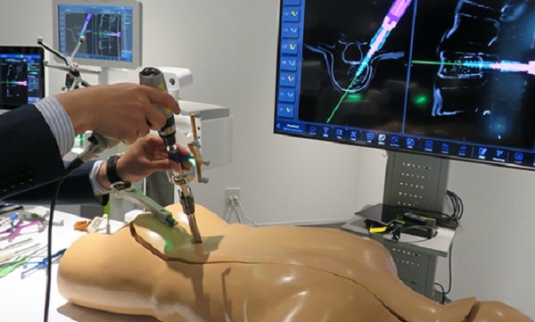 美敦力（Medtronic）正在日本銷售做脊柱疾病手術的機器人